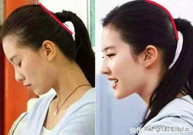 孩子|“妈求求你,别给我睡扁头了”扁头有多毁娃?3张对比图告诉你