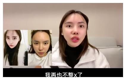 真实颜值|美女网红花70万却整形失败,磨骨伤到神经毁容,自叹非常后悔