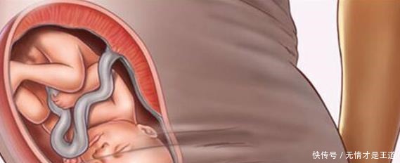 早产|孕28周, 胎宝宝入盆了, 无奈中！