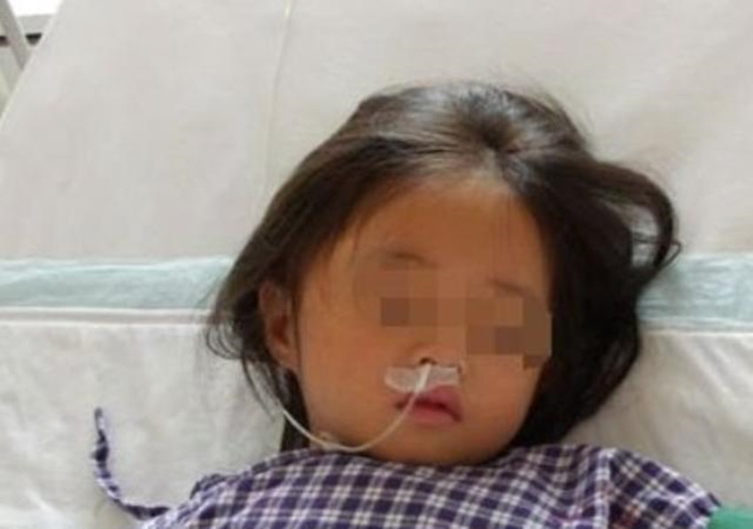 硬币|6岁女童患怪病突然暴瘦,检查时医生让摘项链,妈妈哪里有项链