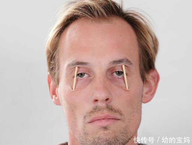 肝硬化患者,头部有三个变化。如果没有,肝脏没问题