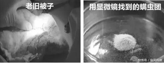 螨虫|90的人都在陪螨虫睡觉螨虫最怕3种东西,好好利用,螨虫跑光光