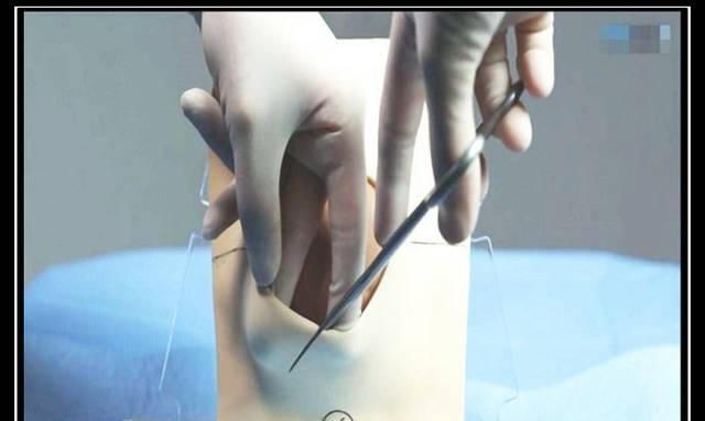 分娩|宝宝顺利出生,媳妇却迟迟没出产房,产房外的丈夫急哭了