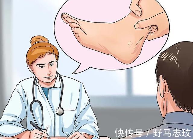 营养均衡|糖尿病腿上出现这种感觉,小心周围神经病变!5个方法可改善