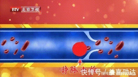 中老年|每天吃一把它，一觉睡到大天亮，中老年适合