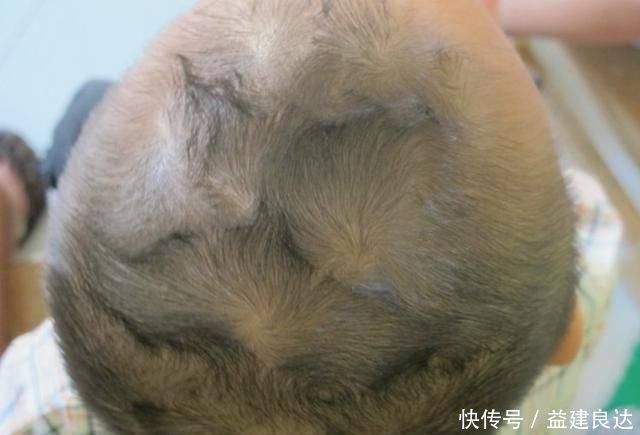 女孩|“双顶男孩找不到,双顶女孩没人要”,孩子头上的“旋”代表了啥