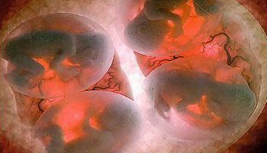 能生|若不避孕,女人一生最多能生多少个娃俄罗斯宝妈亲身经历告诉你