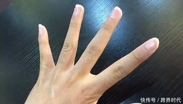 型糖尿病|测血糖时，用第一滴血好，还是第二滴血好？有何区别？