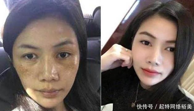 每天“花椒水”加它敷脸，坚持7天美白祛斑，还能去除痘痘！