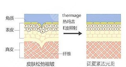 如意集团984亿资产置换解决遗留问题 切入高端纤维新材料领域