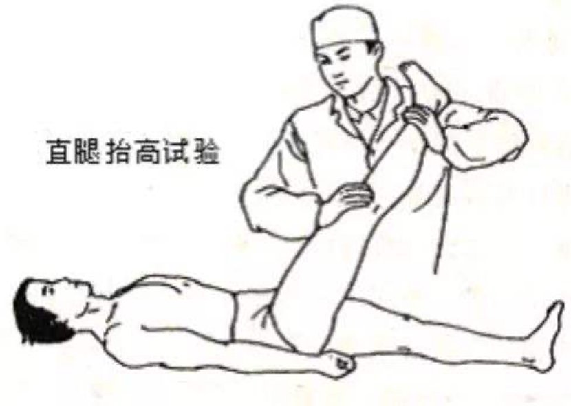 腿疼|腿疼腰痛的你可能冤枉椎间盘了很可能是腚上的问题