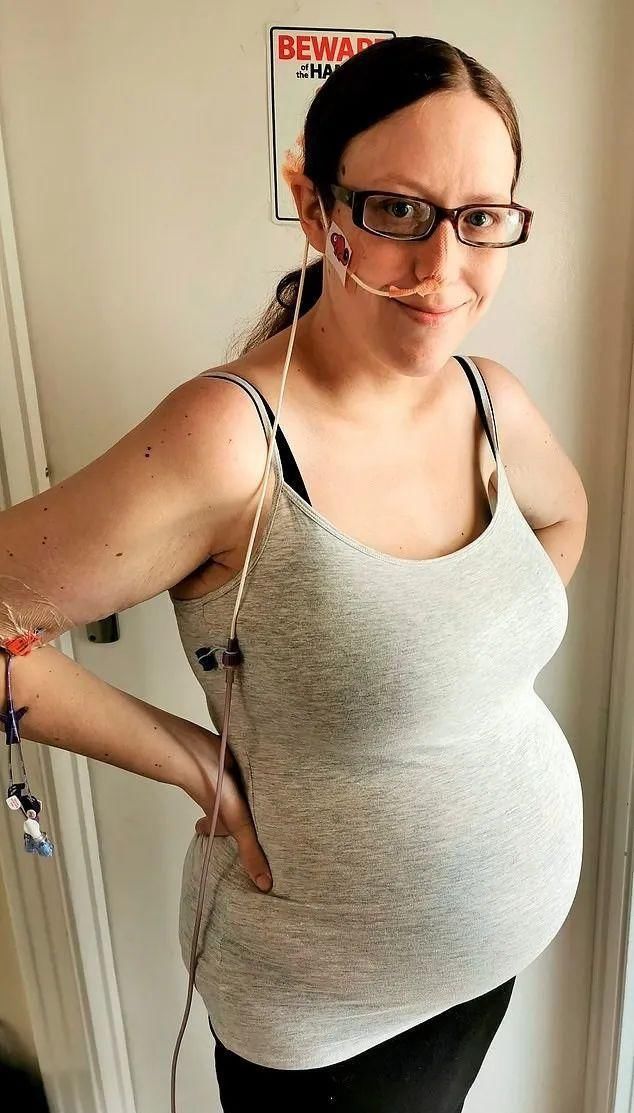 怀孕|孕期每天孕吐50次，生完娃瘦了100斤…这位妈妈也太辛苦了