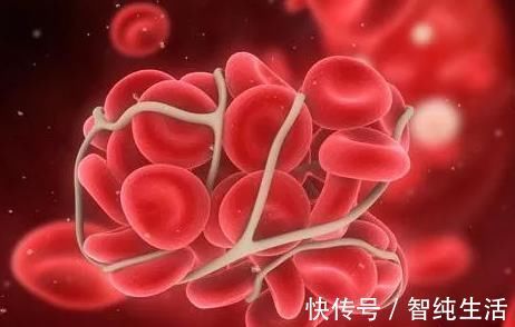 高血脂|高血脂,就不要再多吃这3种食物了,不然血管早晚“堵住”