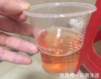 肾脏健康|男性早起“第一次解手”时有3种表现,恭喜,肾还不错