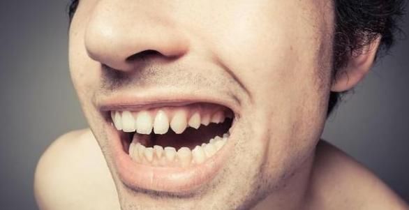 牙膏|牙膏沾了水再刷,但还是一口黄牙,改正3点,和口臭永不相见