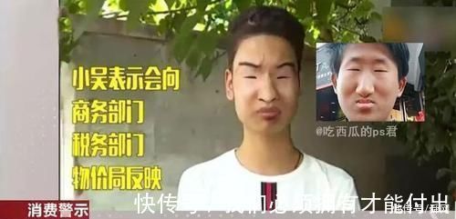 |搞笑p图妹子这膝盖是怎么受伤的,还想要p掉!