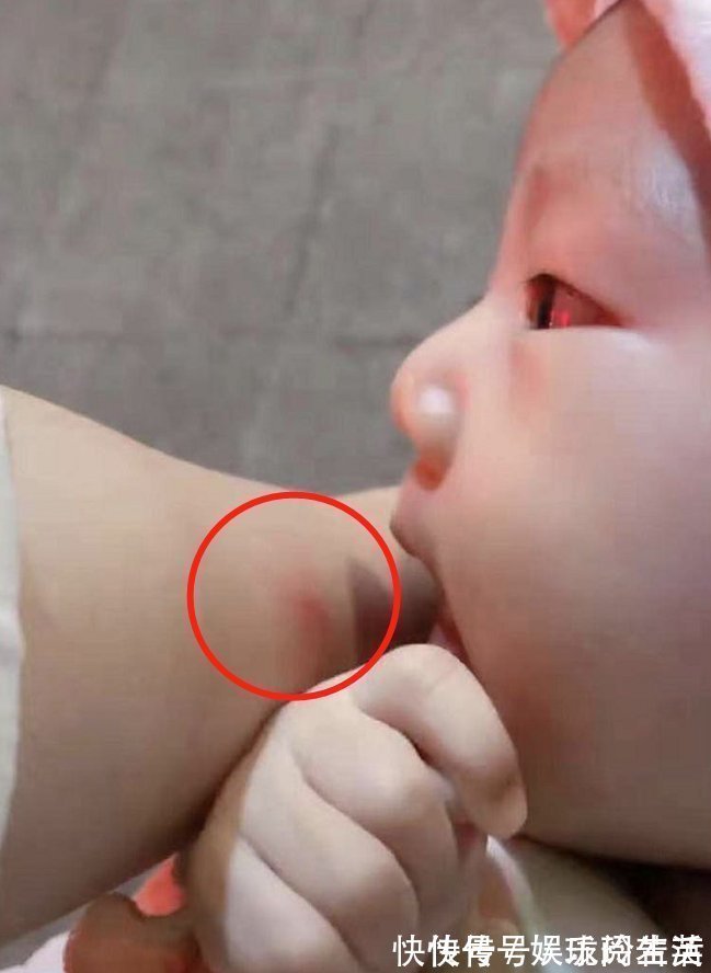 母乳|喂母乳到底有多疼?宝妈用手臂做了实验,网友:心疼妈妈们