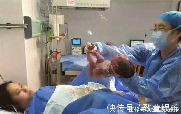 多子|孕妈生下双胞胎后,突然大喊“等一下”,医生检查后发现意外之喜