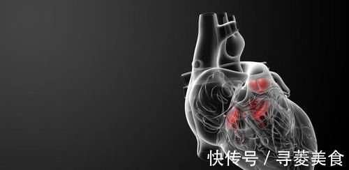 血脂|遇到此物我从不放过,一买就是四五斤,常吃血管变年轻,血脂正常