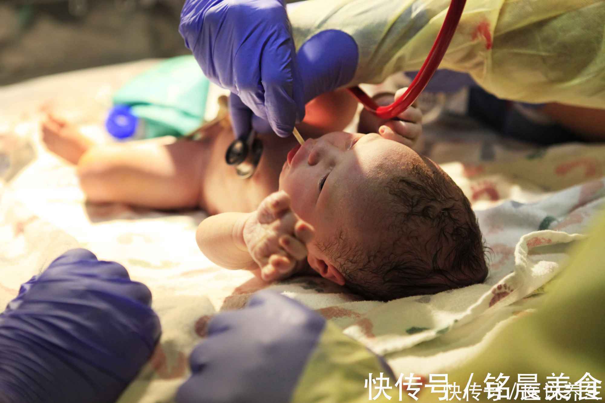 羊水|二胎妈妈43周仍未发动,医生检查后紧急剖腹产,划开后味道刺鼻