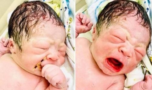 节育器|女子避孕两年仍然怀孕男婴手握节育器出生