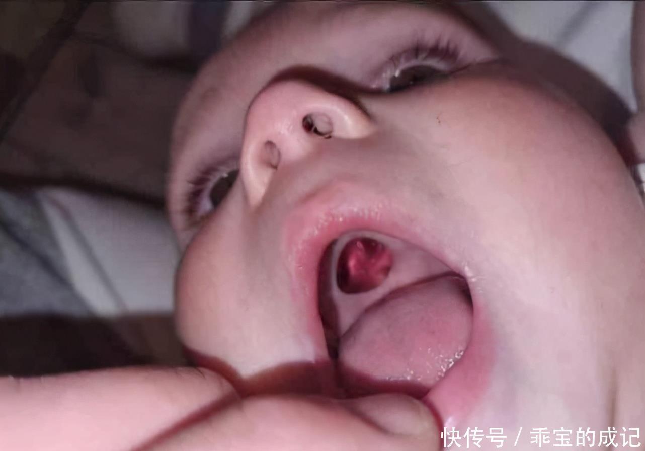 贴纸|宝宝嘴里有个洞?原来是“贴纸”惹的祸,五种物品婴幼儿要远离