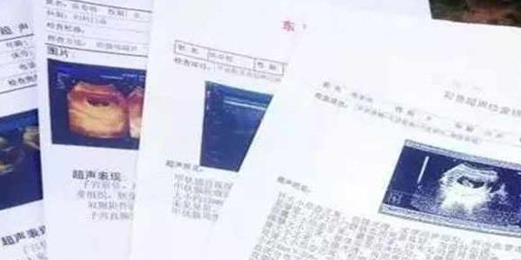 胎儿|孕期这三种症状，表示胎儿缺氧了，孕妈别不当回事，影响胎儿发育