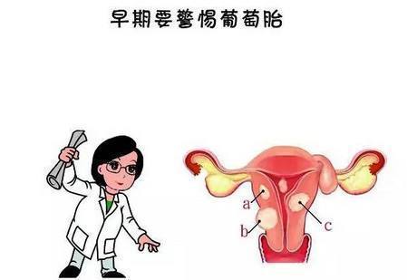 葡萄胎|贝安:葡萄胎清宫后多久可以再次怀孕?