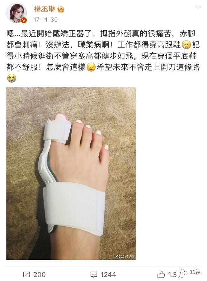 扁平足|姑娘穿平底鞋,走一天路痛到不行…原来穿鞋还得看脚型?
