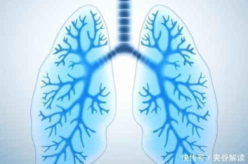 癌细胞|身体没有这3个异常,说明肺部还很健康,肺癌离你很远