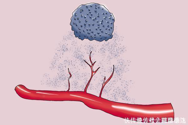 诱发|不容易得癌的人,都具备什么条件专家说出4个,你有没有