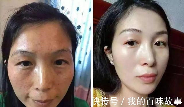 脸部|马齿苋加“它”涂抹脸部,7天下来淡化色斑又嫩肤,皮肤白净光滑!