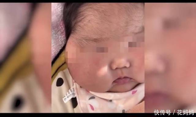 婴儿|“消”字号婴儿霜,致5个月宝宝全身发胖,发育迟缓,脸上长毛