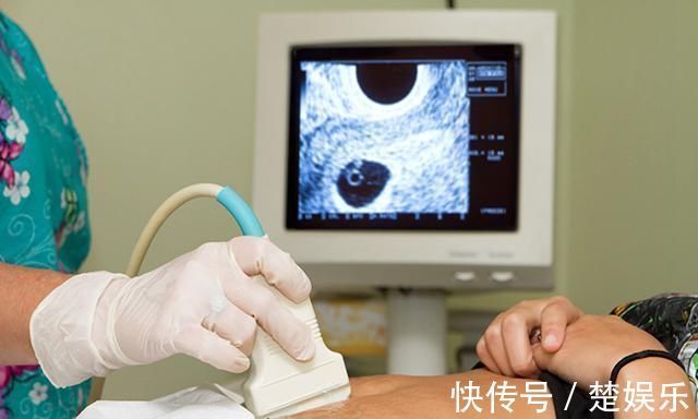 四维彩超|孕期最关键的4次产检,就算再忙,宝爸也要陪孕妈一起