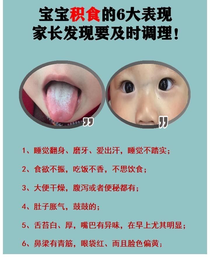 小儿积食|小儿积食的6大症状尤为明显,这么调理修正