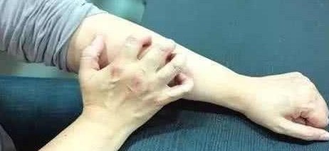 降糖控糖|身体发出5个信号，或是糖尿病找上门，抓紧降糖，远离并发症