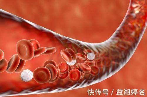 血管健康|颈动脉斑块怎么防治?呵护血管健康,3个健康常识,一个也不能少