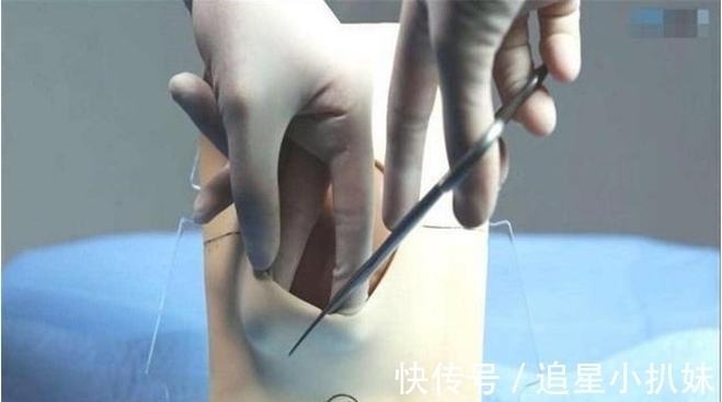 孩子|为什么说顺产很痛?网友:光是看图就觉得很疼了!