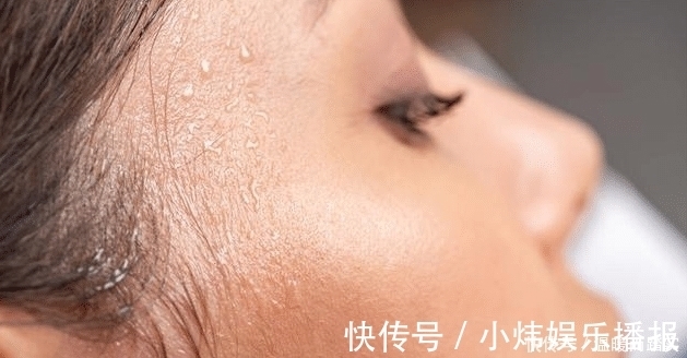 满身|为什么有人从不出汗,有人动不动就满身汗?中医告诉你原因!