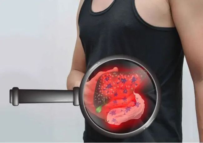 生存期|一旦确诊肝癌，究竟还能活多久？医生坦白：关键要看这3点