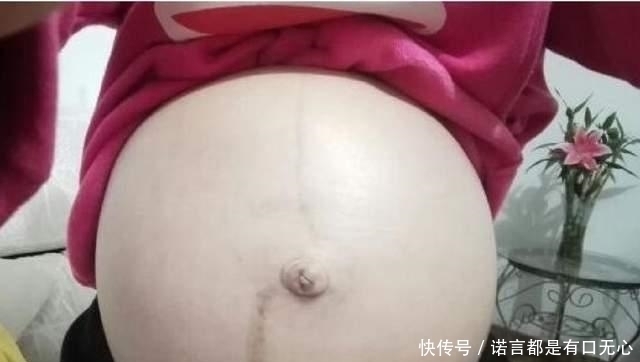 秘密|怀孕后肚子上的“黑线”是什么？妊娠中线的秘密，你有必要了解
