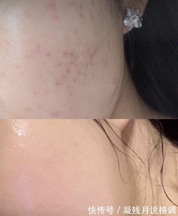 肌肤|隐藏在屈臣氏的“低调”精华液,因价低无人问津!用后嫩肤还去黄