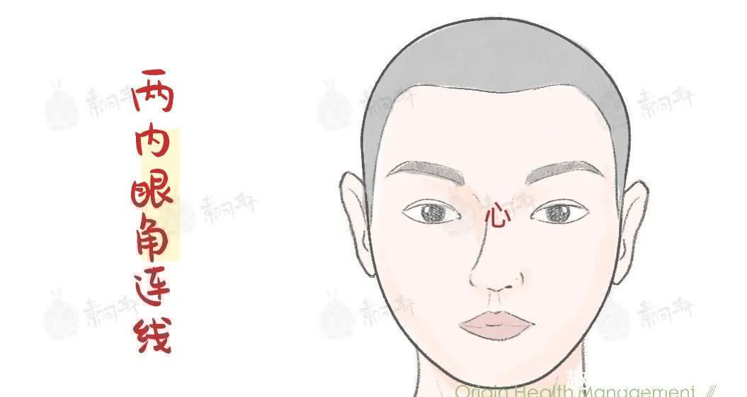 横纹|脸上这个痕迹，竟能1秒检测心脏病！很多人都中招了……