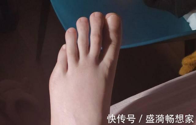 脚型|宝宝出生脚趾比手指还长,妈妈高兴不起来,网友基因突变