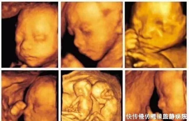 b超|孕期产检不想生个“傻孩子”,这三项产检必须按时做,不能忽视