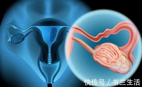 绝经|宫颈有癌,月经先发现, 月经有2个变化,不要拖拉,早去检查