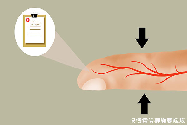 小区公园|男子糖尿病30年,血糖平稳、没有并发症,他的降糖秘诀,值得学习