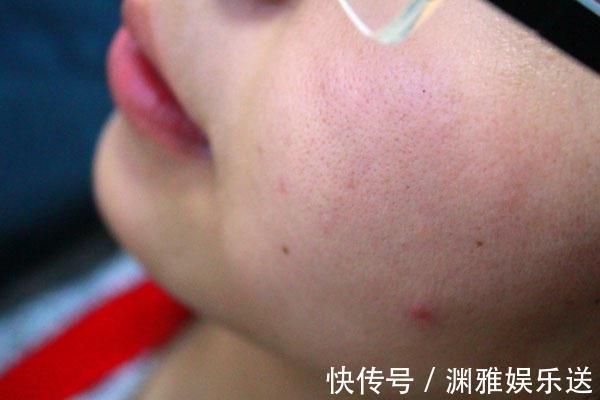 黄褐斑|子宫不太好的女性，脸上或会出现四种表现，若都没有，子宫很健康