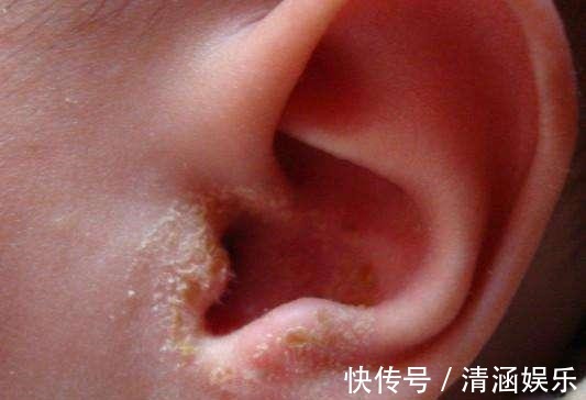 宝宝|2岁宝宝平时一习惯,妈妈送去医院检查,医生还好来得早