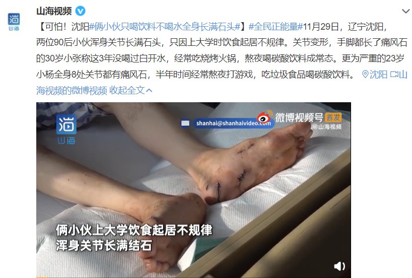 男子|可怕！男子全身布满＂石头＂，只因喜欢…这些习惯很多人都有